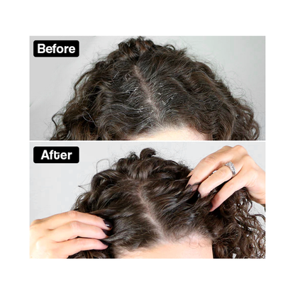 Derivra Scalp Care Comb
